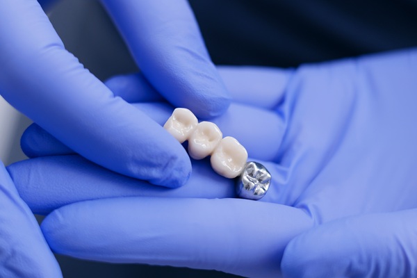 Types Of Dental Bridges: Choosing The Right Option For Your Smile