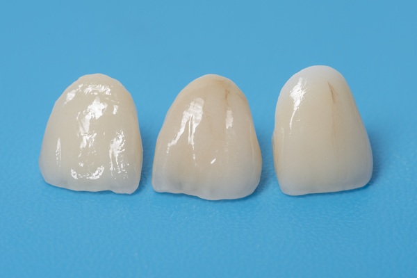 The Steps Of A Dental Crown Restoration