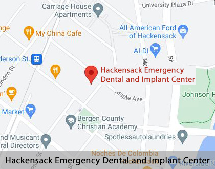 Map image for Implant Dentist in Hackensack, NJ