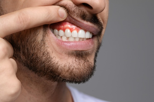 Periodontics: The Key To Healthy Gums And A Strong Foundation For Your Teeth